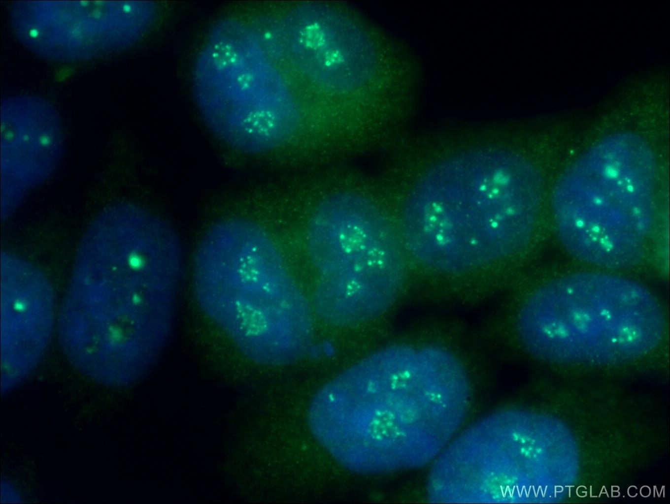 Immunofluorescence (IF) / fluorescent staining of HeLa cells using STK3 Polyclonal antibody (12097-1-AP)