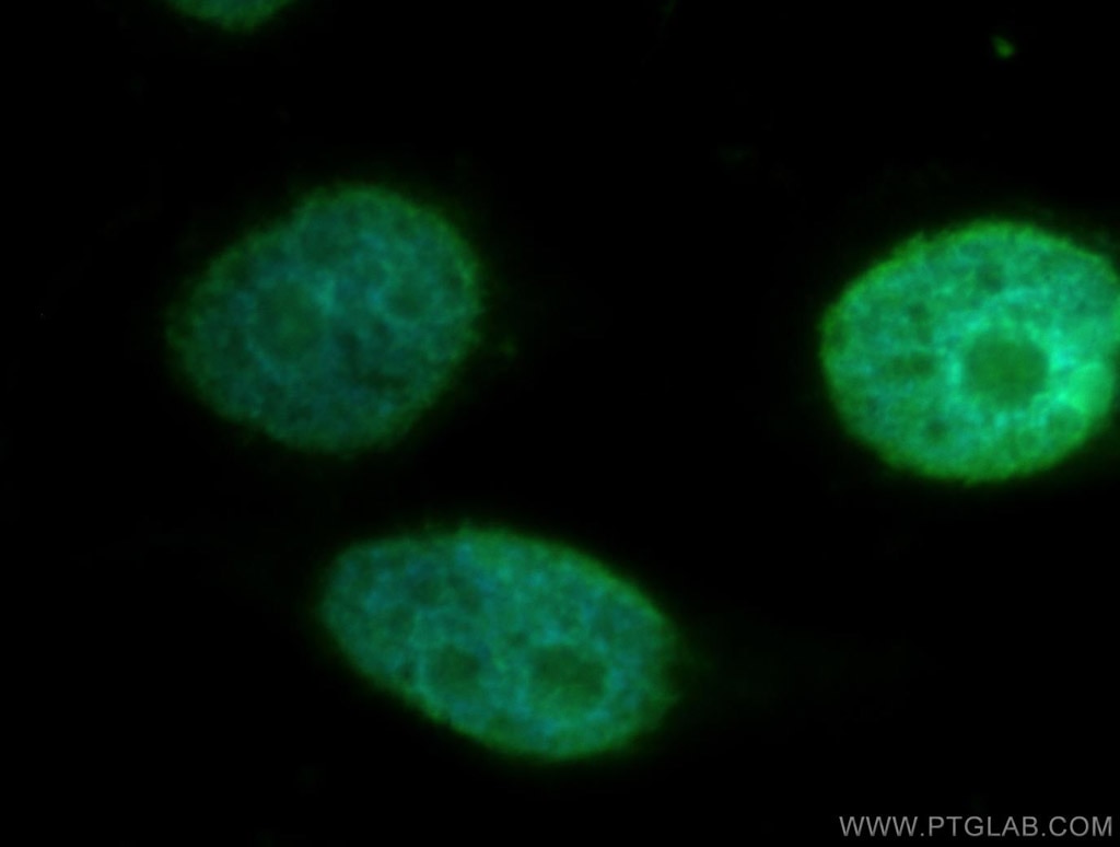 Immunofluorescence (IF) / fluorescent staining of HeLa cells using STK3 Polyclonal antibody (12097-1-AP)