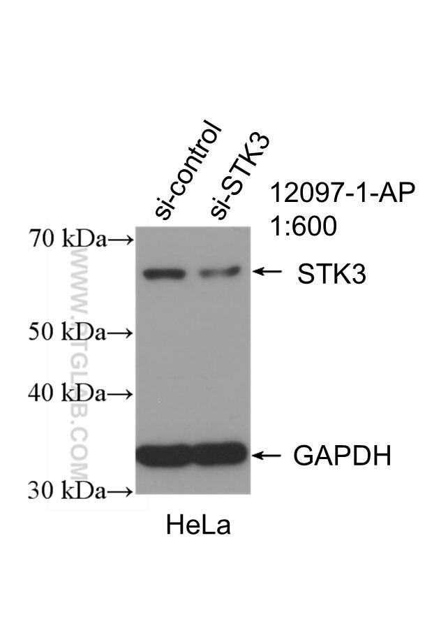 Western Blot (WB) analysis of HeLa cells using STK3 Polyclonal antibody (12097-1-AP)
