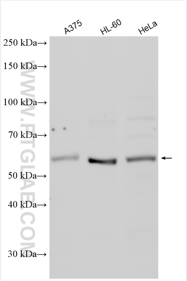 Western Blot (WB) analysis of various lysates using STK3 Polyclonal antibody (12097-1-AP)