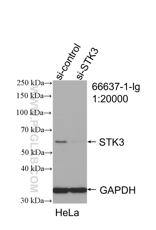 Western Blot (WB) analysis of HeLa cells using STK3 Monoclonal antibody (66637-1-Ig)