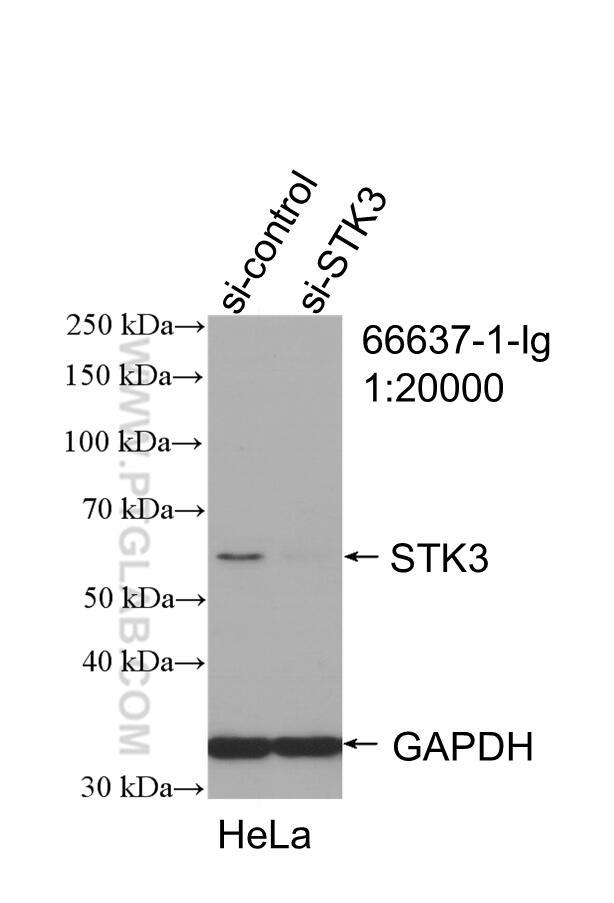 WB analysis of HeLa using 66637-1-Ig