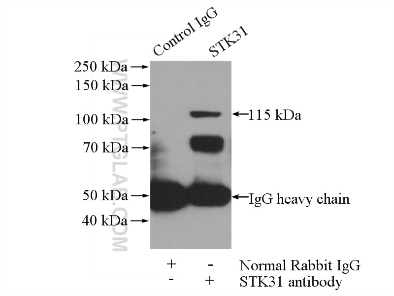 Immunoprecipitation (IP) experiment of mouse testis tissue using STK31 Polyclonal antibody (14140-1-AP)