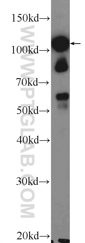 Western Blot (WB) analysis of mouse testis tissue using STK31 Polyclonal antibody (14140-1-AP)