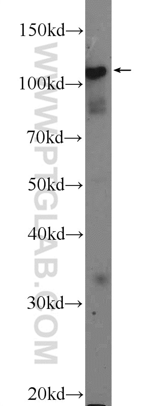 Western Blot (WB) analysis of mouse testis tissue using STK31 Polyclonal antibody (14140-1-AP)