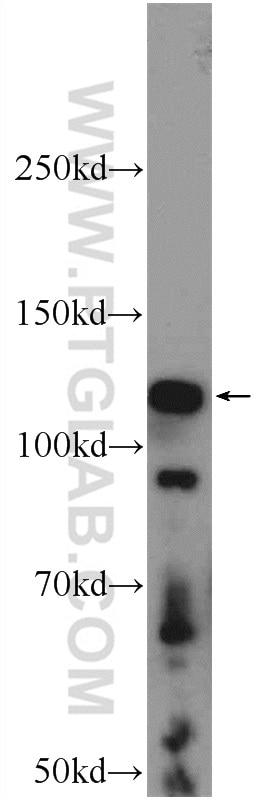 Western Blot (WB) analysis of rat testis tissue using STK31 Polyclonal antibody (14140-1-AP)