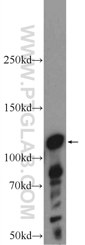 Western Blot (WB) analysis of mouse testis tissue using STK31 Polyclonal antibody (14140-1-AP)