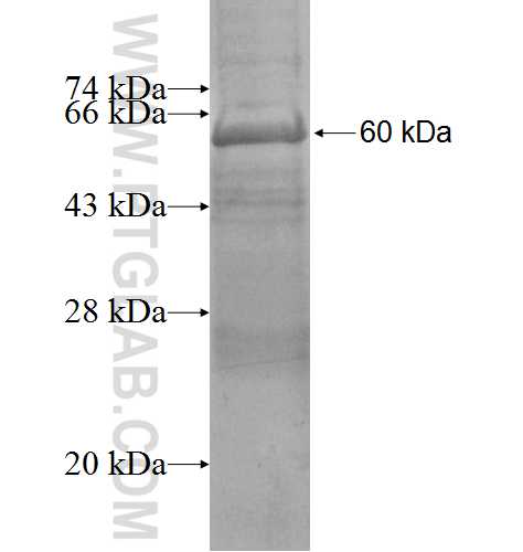 STK31 fusion protein Ag5221 SDS-PAGE
