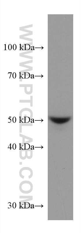 Western Blot (WB) analysis of A549 cells using STK32A Monoclonal antibody (67528-1-Ig)