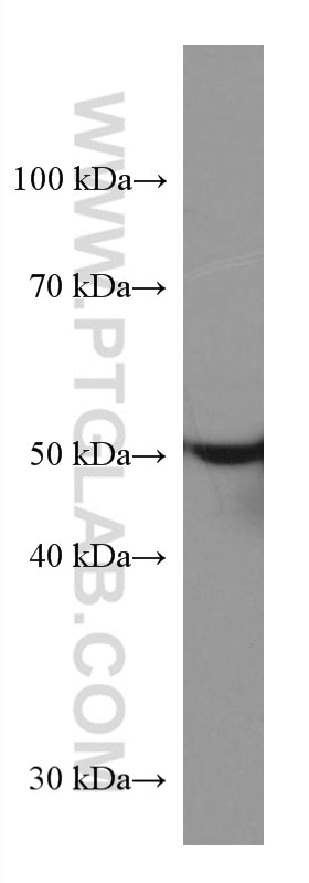 Western Blot (WB) analysis of HeLa cells using STK32A Monoclonal antibody (67528-1-Ig)