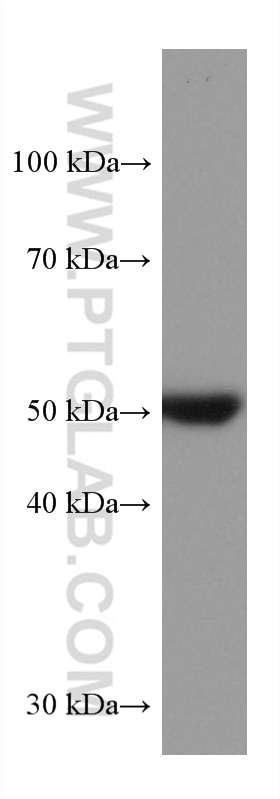 Western Blot (WB) analysis of T-47D cells using STK32A Monoclonal antibody (67528-1-Ig)