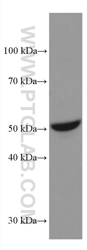 Western Blot (WB) analysis of JAR cells using STK32A Monoclonal antibody (67528-1-Ig)