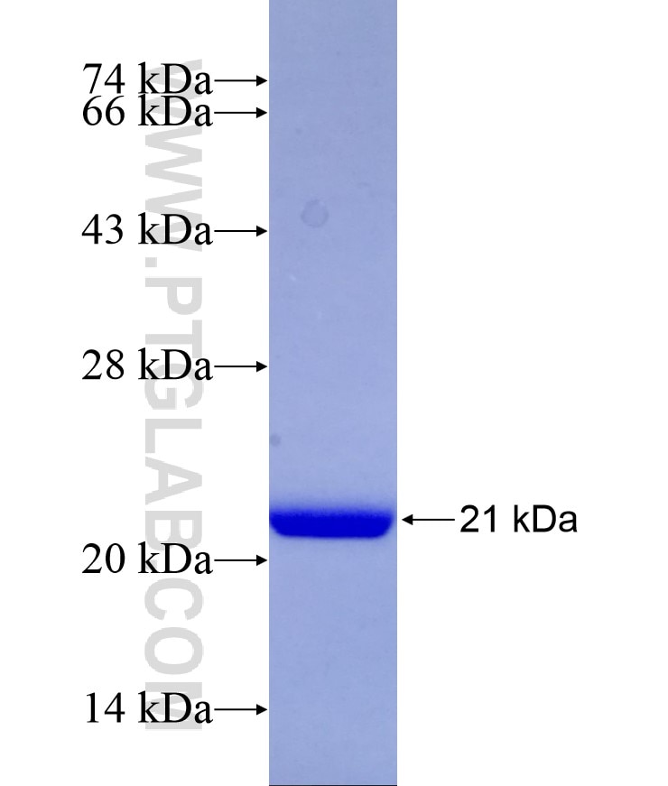 STK32A fusion protein Ag10942 SDS-PAGE