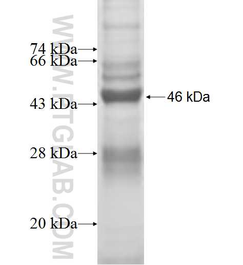STK32A fusion protein Ag9276 SDS-PAGE