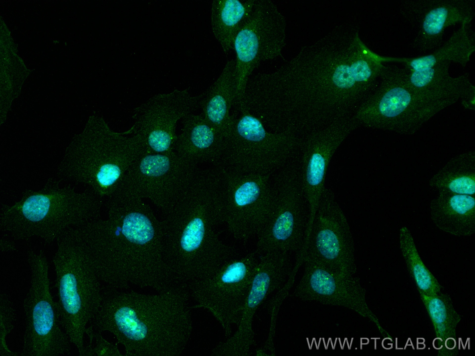 Immunofluorescence (IF) / fluorescent staining of U2OS cells using STK32B Polyclonal antibody (15438-1-AP)