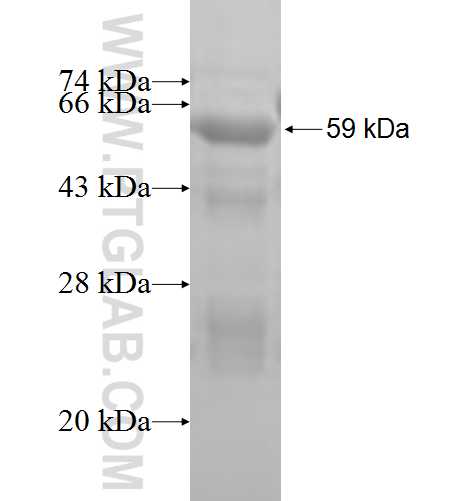STK32B fusion protein Ag4507 SDS-PAGE