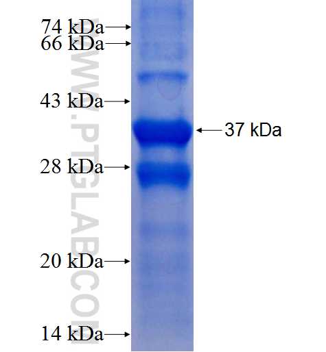 STK32B fusion protein Ag8271 SDS-PAGE