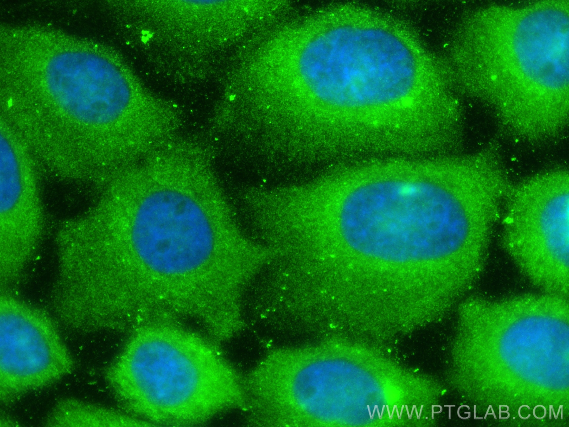 Immunofluorescence (IF) / fluorescent staining of A431 cells using STK32C Polyclonal antibody (11434-1-AP)