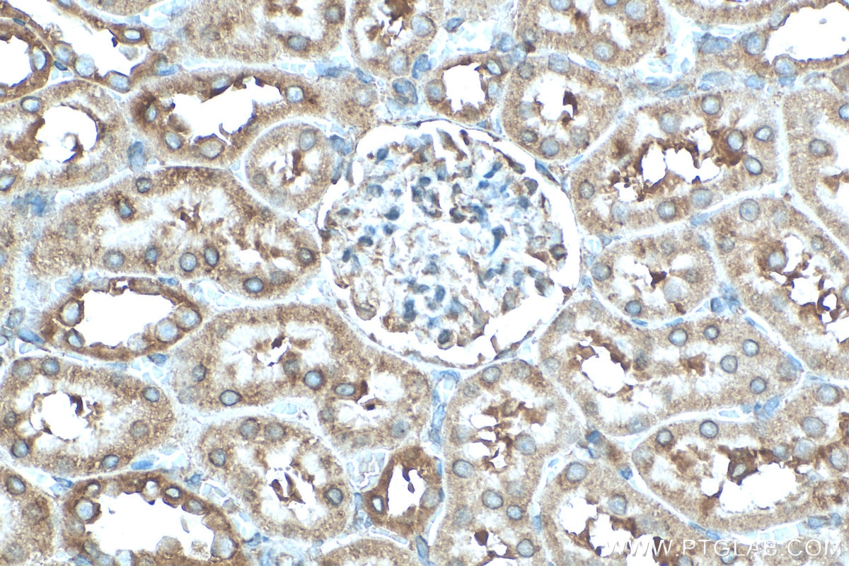 Immunohistochemistry (IHC) staining of rat kidney tissue using STK32C Polyclonal antibody (11434-1-AP)
