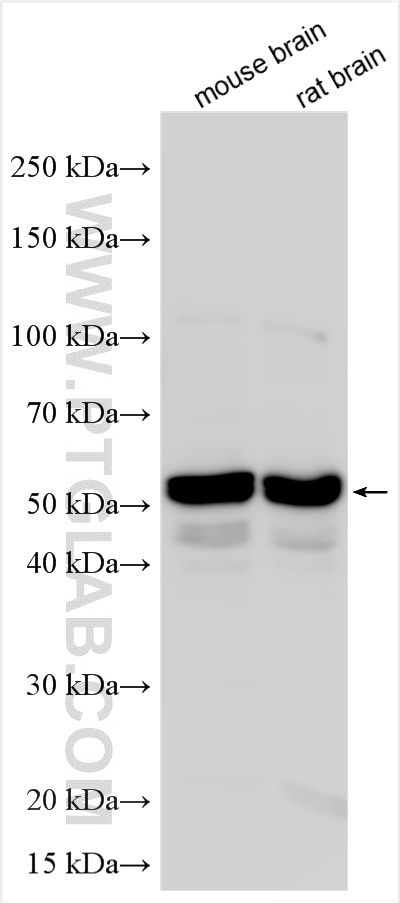 Western Blot (WB) analysis of various lysates using STK32C Polyclonal antibody (11434-1-AP)