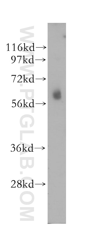 STK32C