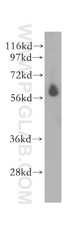 STK32C
