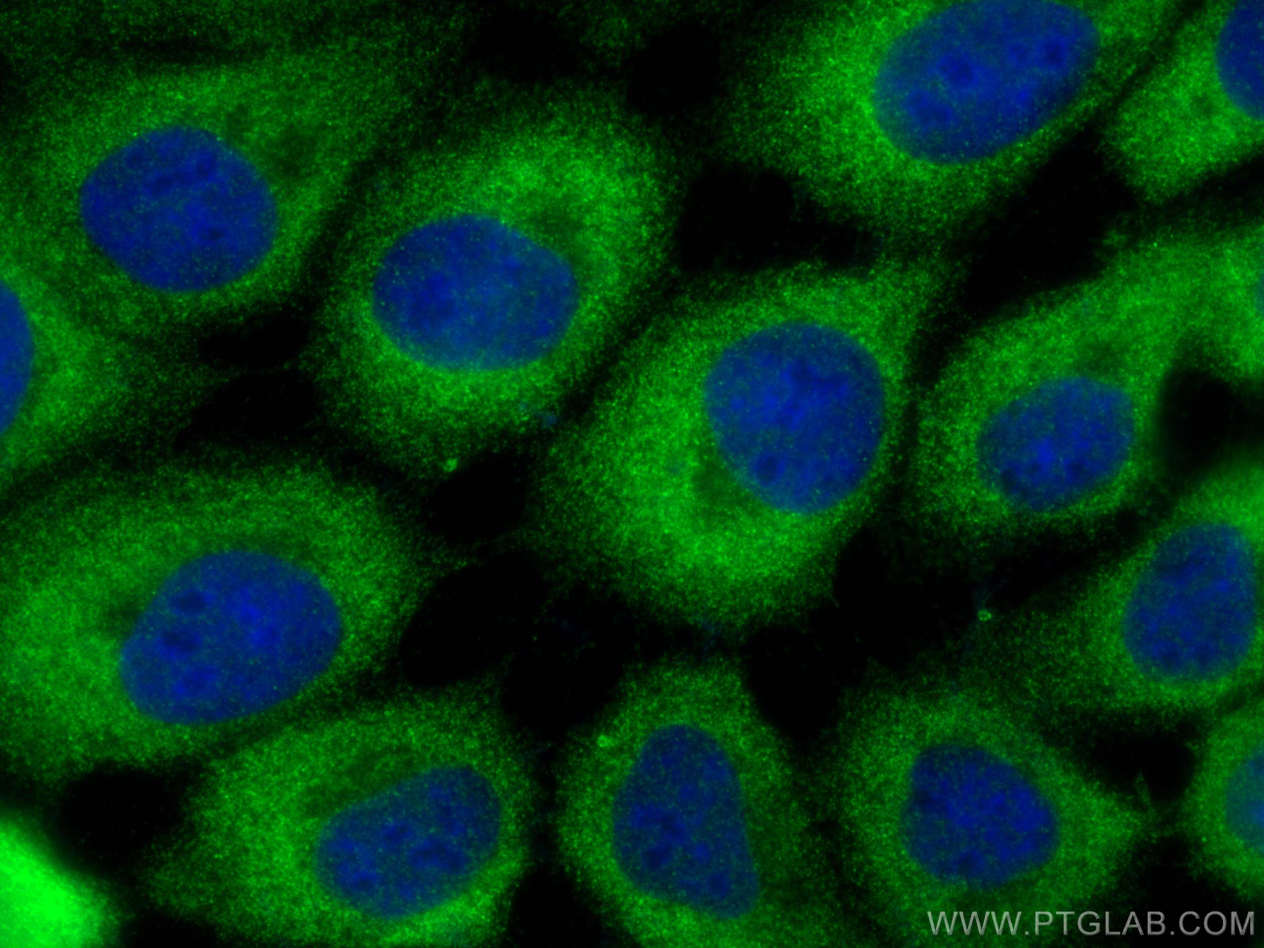 Immunofluorescence (IF) / fluorescent staining of A431 cells using STK33 Polyclonal antibody (12857-1-AP)