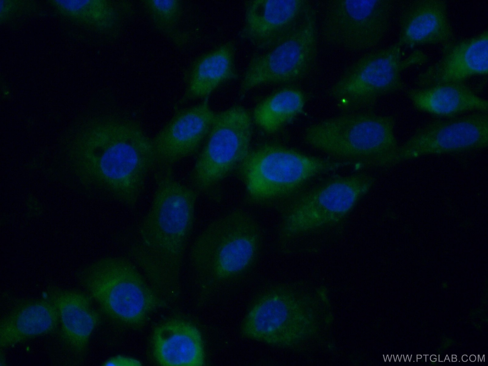 Immunofluorescence (IF) / fluorescent staining of A431 cells using STK33 Polyclonal antibody (12857-1-AP)