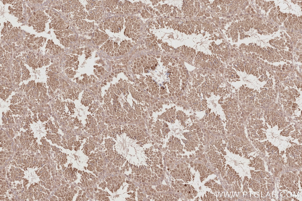 Immunohistochemistry (IHC) staining of mouse testis tissue using STK33 Polyclonal antibody (12857-1-AP)