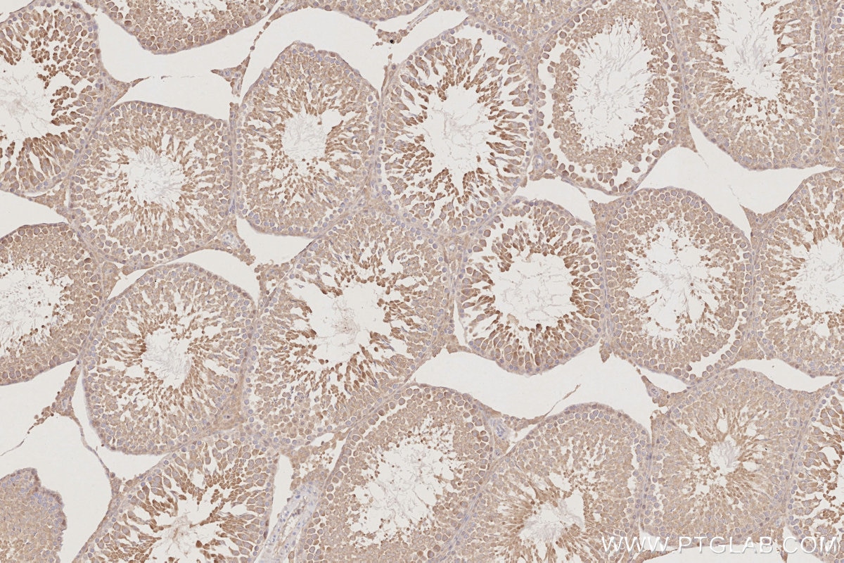 Immunohistochemistry (IHC) staining of rat testis tissue using STK33 Polyclonal antibody (12857-1-AP)