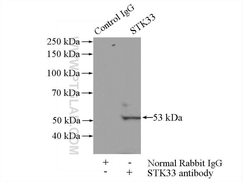 Immunoprecipitation (IP) experiment of HEK-293 cells using STK33 Polyclonal antibody (12857-1-AP)