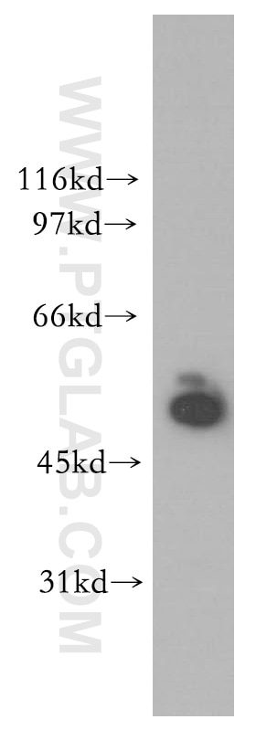 Western Blot (WB) analysis of human kidney tissue using STK33 Polyclonal antibody (12857-1-AP)