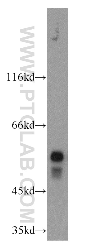 Western Blot (WB) analysis of mouse testis tissue using STK33 Polyclonal antibody (12857-1-AP)