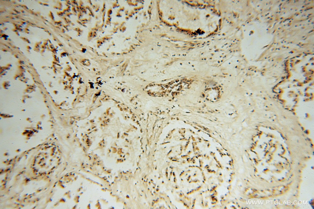 Immunohistochemistry (IHC) staining of human prostate tissue using STK36 Polyclonal antibody (12559-1-AP)