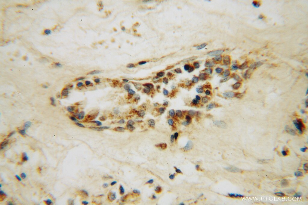 Immunohistochemistry (IHC) staining of human prostate tissue using STK36 Polyclonal antibody (12559-1-AP)