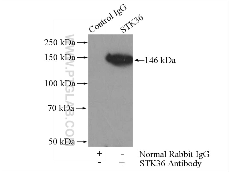 Immunoprecipitation (IP) experiment of mouse testis tissue using STK36 Polyclonal antibody (12559-1-AP)