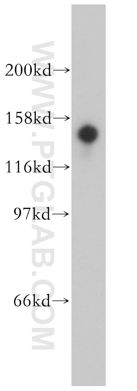 Western Blot (WB) analysis of mouse testis tissue using STK36 Polyclonal antibody (12559-1-AP)