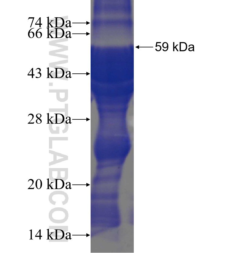 STK36 fusion protein Ag3279 SDS-PAGE