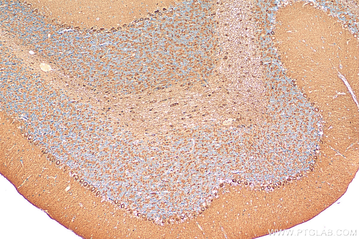 Immunohistochemistry (IHC) staining of mouse cerebellum tissue using STK38 Polyclonal antibody (11105-1-AP)