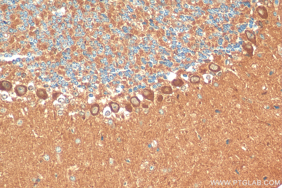 Immunohistochemistry (IHC) staining of mouse cerebellum tissue using STK38 Polyclonal antibody (11105-1-AP)