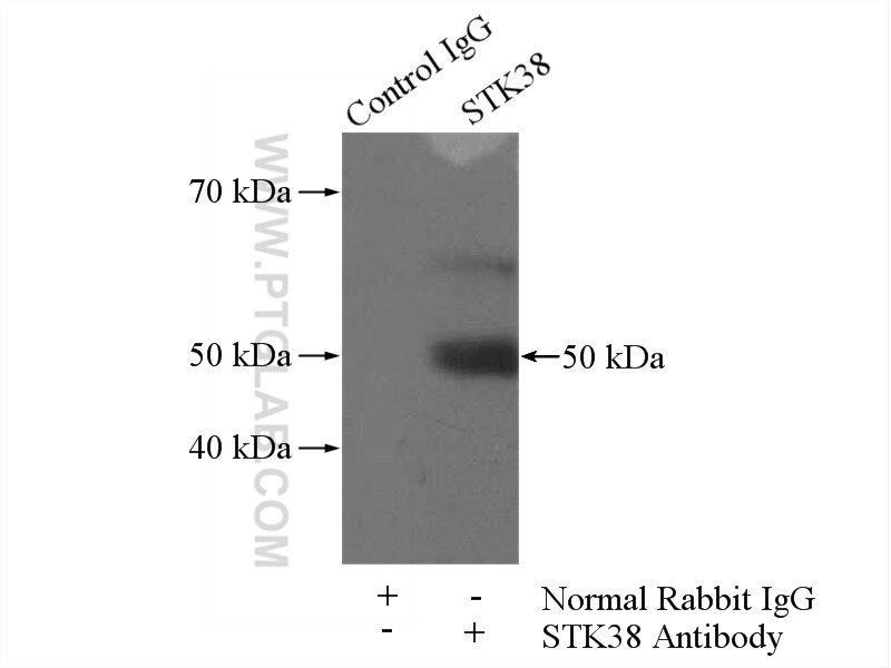 Immunoprecipitation (IP) experiment of MCF-7 cells using STK38 Polyclonal antibody (11105-1-AP)