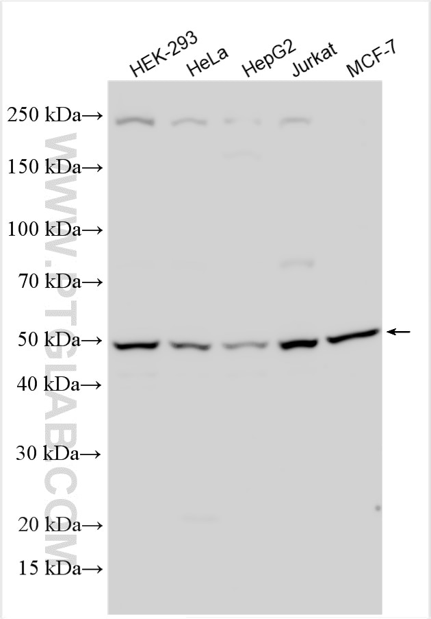 Western Blot (WB) analysis of various lysates using STK38 Polyclonal antibody (11105-1-AP)