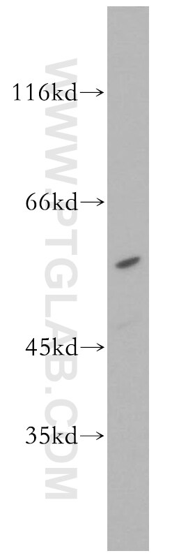 STK38 Polyclonal antibody