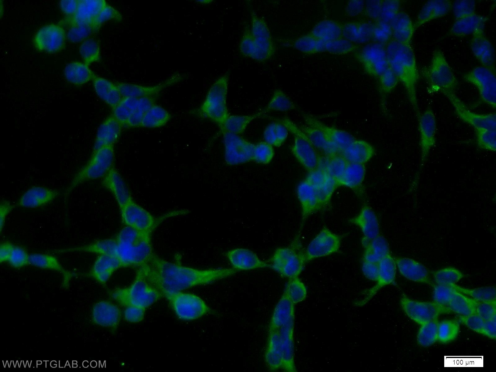 Immunofluorescence (IF) / fluorescent staining of HEK-293 cells using STK38 Polyclonal antibody (55335-1-AP)