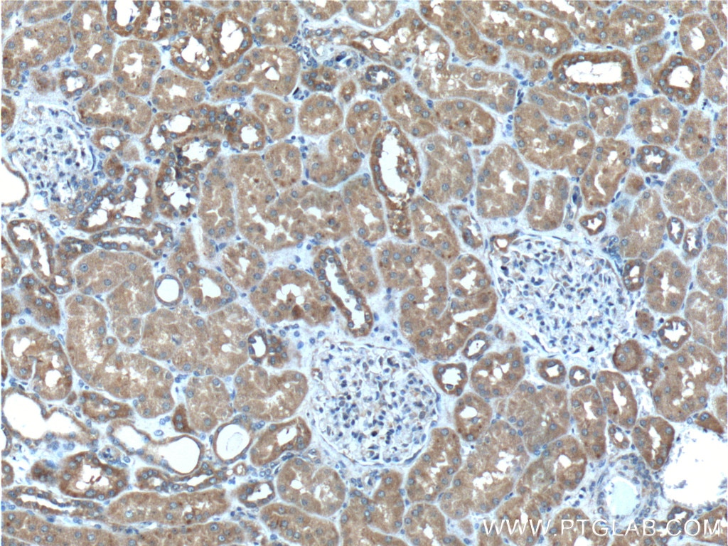 IHC staining of human kidney using 55335-1-AP