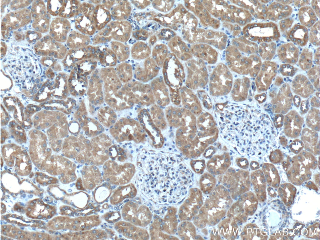 Immunohistochemistry (IHC) staining of human kidney tissue using STK38 Polyclonal antibody (55335-1-AP)