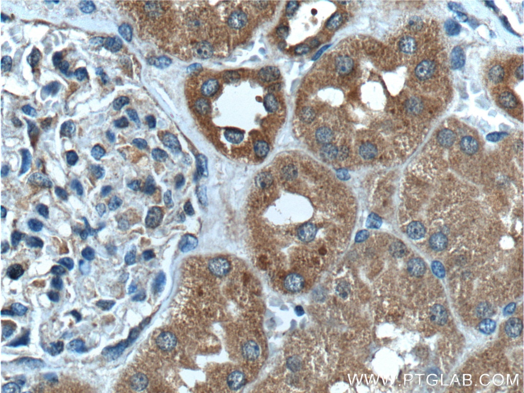 Immunohistochemistry (IHC) staining of human kidney tissue using STK38 Polyclonal antibody (55335-1-AP)