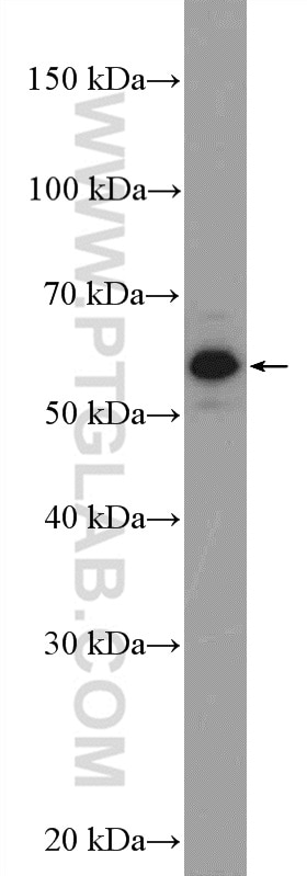 Western Blot (WB) analysis of MCF-7 cells using STK38 Polyclonal antibody (55335-1-AP)