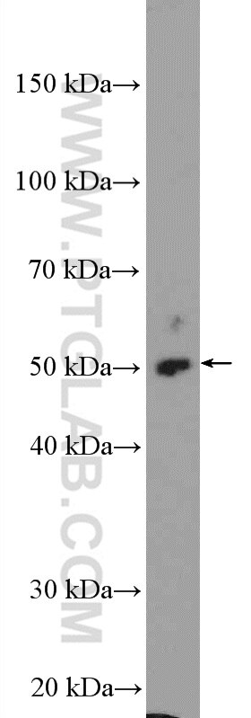 Western Blot (WB) analysis of HeLa cells using STK38 Polyclonal antibody (55335-1-AP)