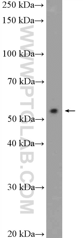 Western Blot (WB) analysis of MCF-7 cells using STK38 Polyclonal antibody (55335-1-AP)